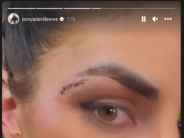 Sonya Deville reveals a nasty wound from a recent WWE live event