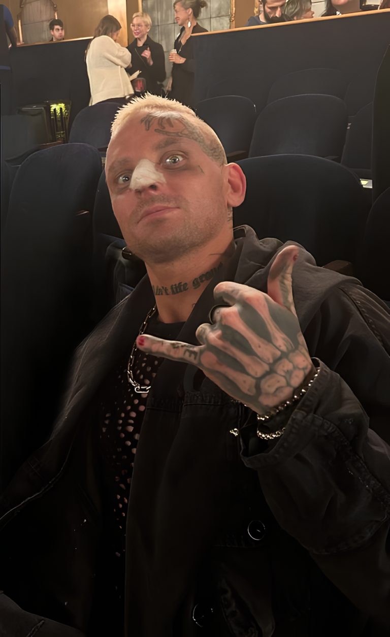 Darby Allin Sidelined After Being Hit by a Bus During Injury Break ...