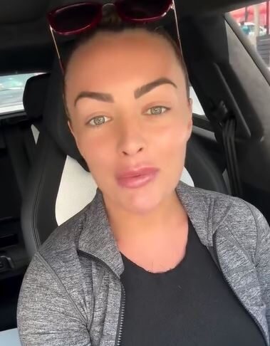 Mandy Rose Reverses Cosmetic Surgery and Explores New Horizons