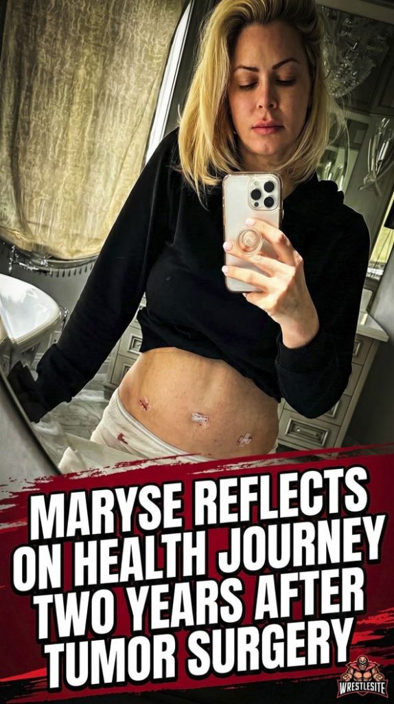 Maryse Reflects on Health Journey Two Years After Tumor Surgery