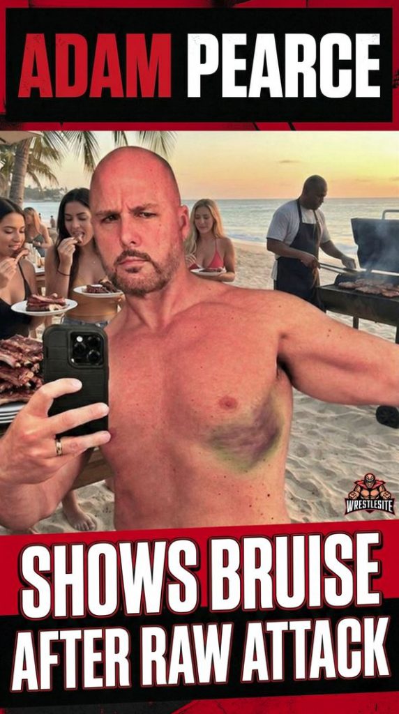 Adam Pearce Shows Bruise After RAW Attack