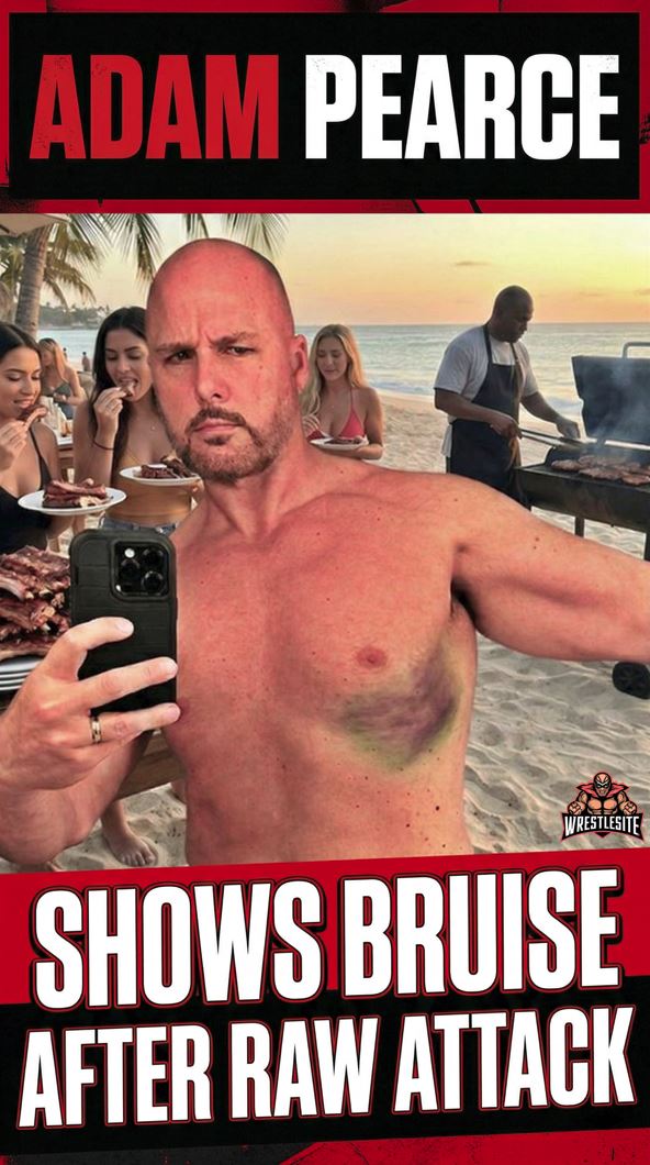 Adam Pearce Shows Bruise After RAW Attack