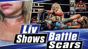 Liv Morgan Reveals SmackDown Battle Scars
