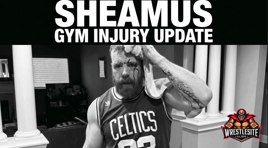 Sheamus Suffers Head Wound In Gym Accident 5 Sheamus holds a towel to his bloody head wound after a gym accident during WWE injury recovery