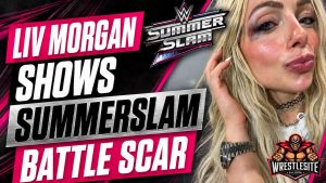 Liv Morgan Shows Off Bruised Eye After SummerSlam Victory