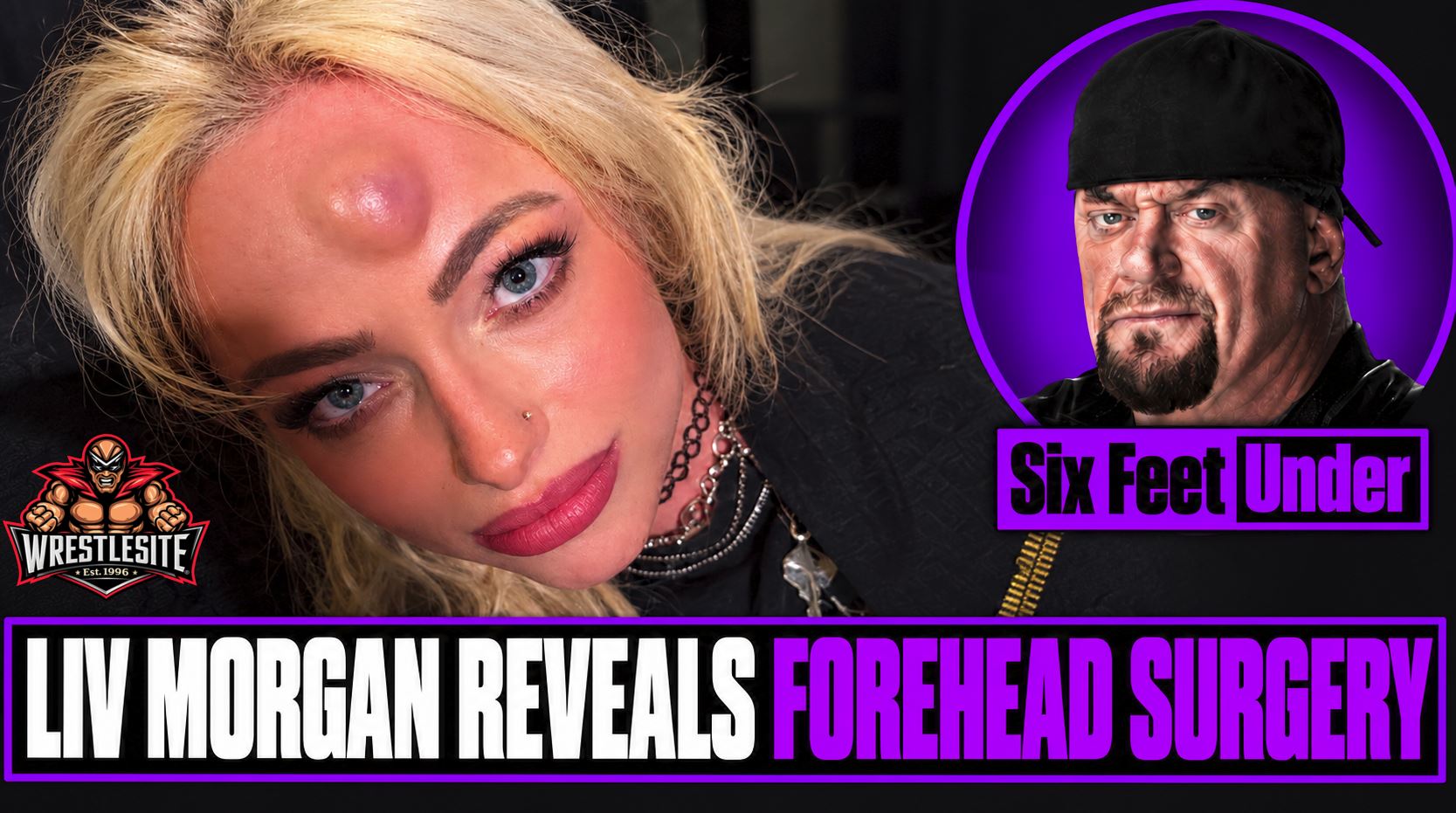 Liv Morgan Reveals Forehead Surgery 5 Liv Morgan discusses forehead injury treatment and fat graft surgery following collision with Roxanne Perez